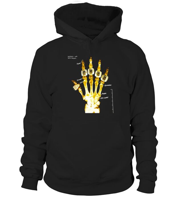 Official Kobe Hand X Ray gold Hoodie Unisex